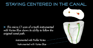 Vortex Blue Diagram