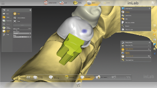 inLab CAD Software, individual attachment prosthesis