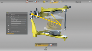 inLab CAD Software, Virtual articulator