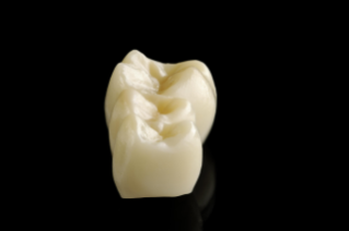 Teeth made from CEREC dental milling machine