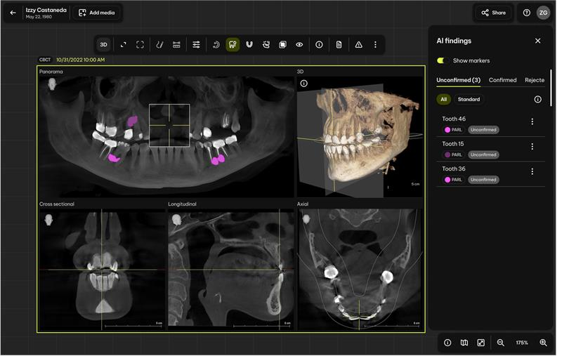 Dentsply Sirona Launches Smart View - Detect, World's First FDA