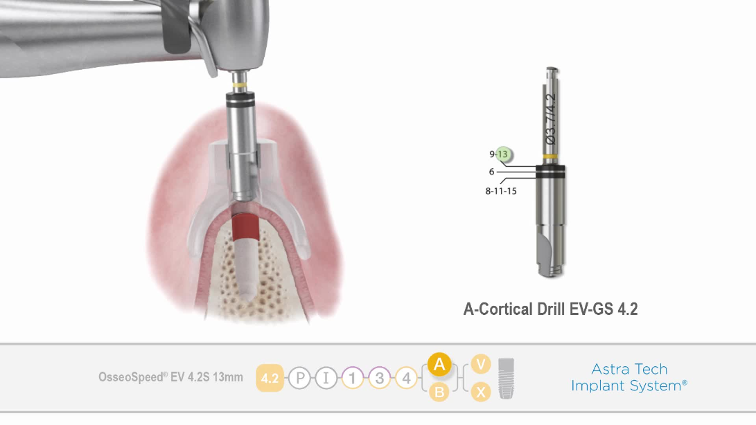 Dentsply Sirona USA: Dental products and technologies USA