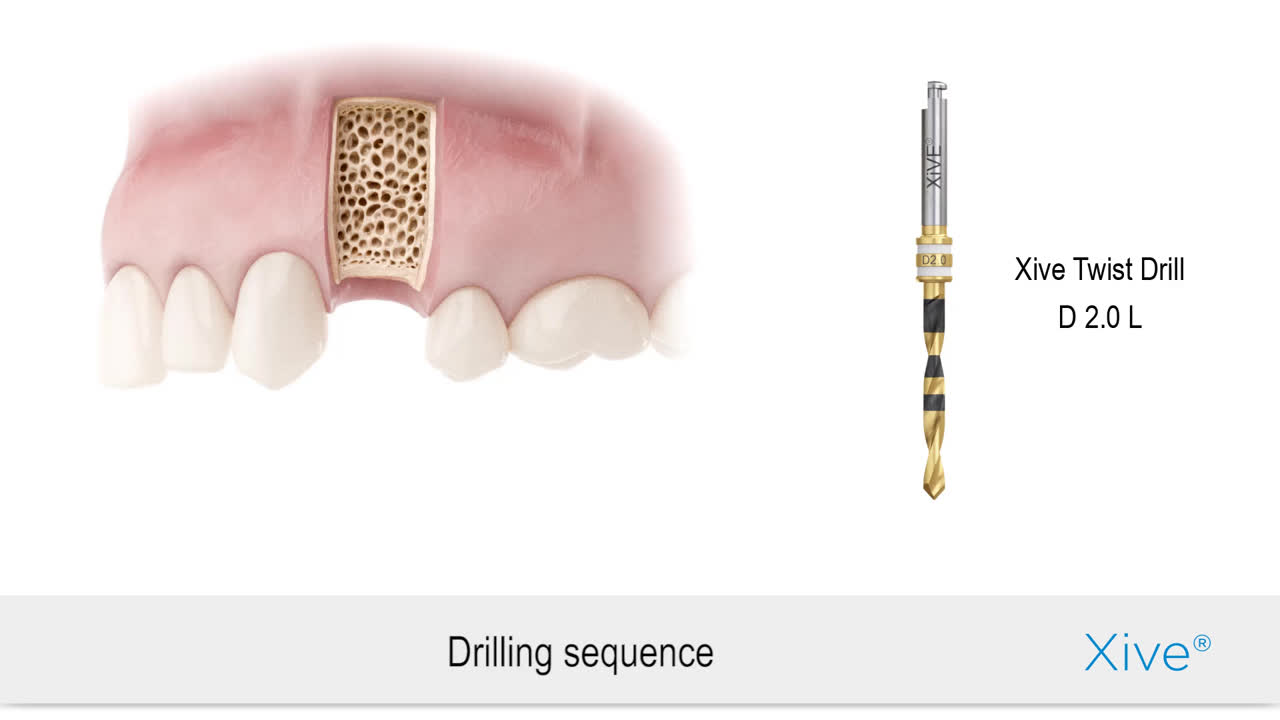 Dentsply Sirona USA: Dental products and technologies USA