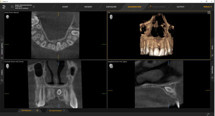 X-ray of digital dental unit Axeos 