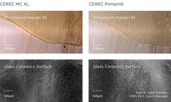 Comparison surface structure and margin fit CEREC MC XL and CEREC Primemill