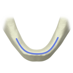 Non-splinted restorations in the mandible