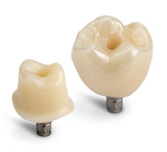 CEREC Cercon 4D™ Abutment Block Image of Abutment and Crown
