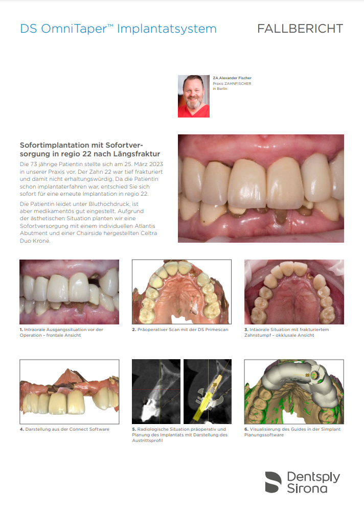 DS OmniTaperImplantatsystem EV Dentsply Sirona Österreich
