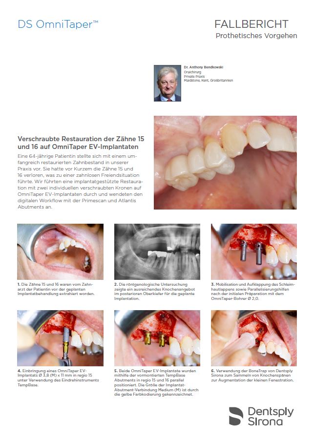 DS OmniTaperImplantatsystem EV Dentsply Sirona Österreich