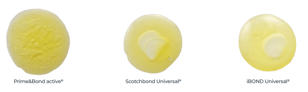 Class II | Prime&Bond Adhesive Placement | without Text