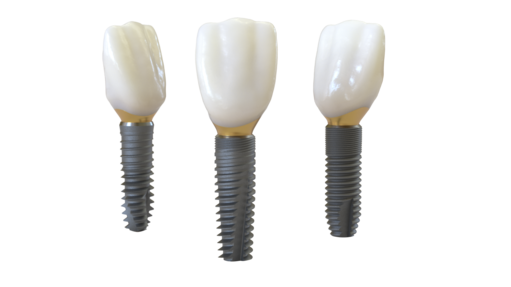 EV-Implantat-Familie