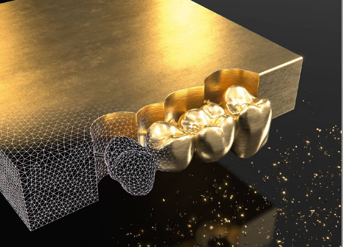 Golden Surfer
