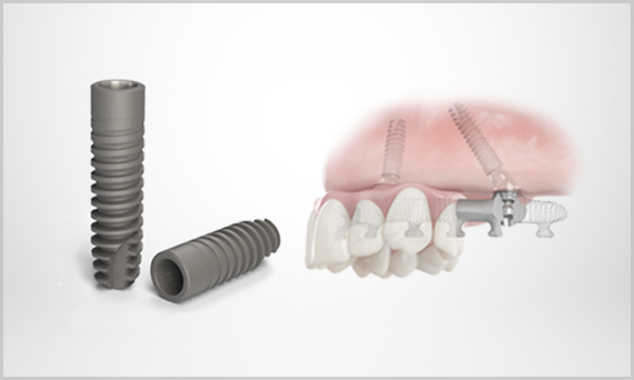 SmartFix Implantat-Behandlungskonzept | Dentsply Sirona Deutschland