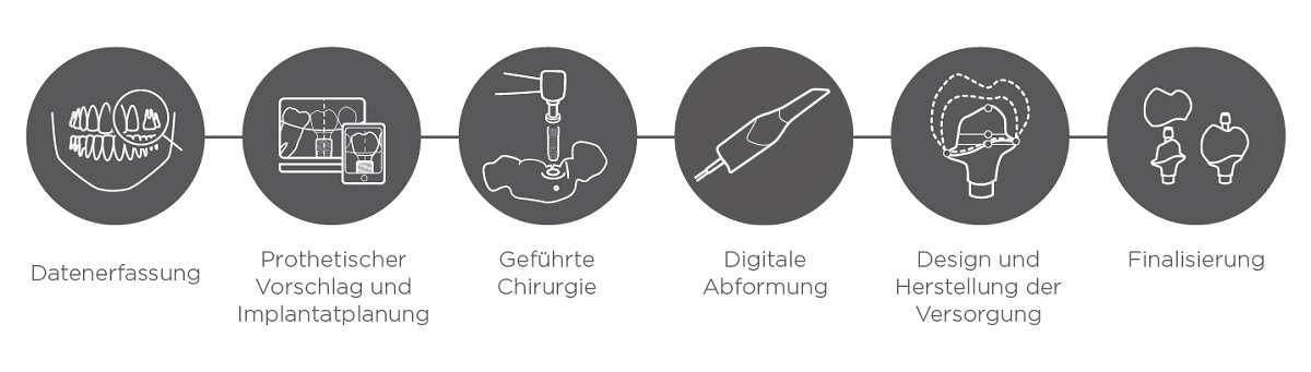 Workflow digitale Implantologie