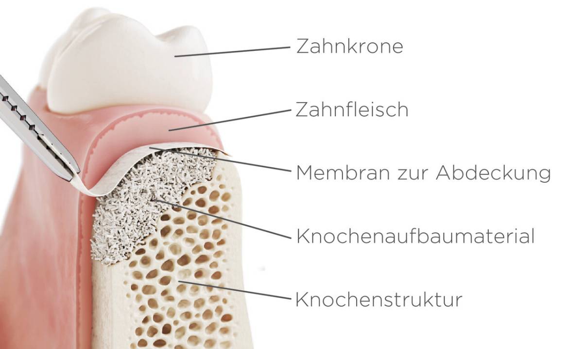 Druck