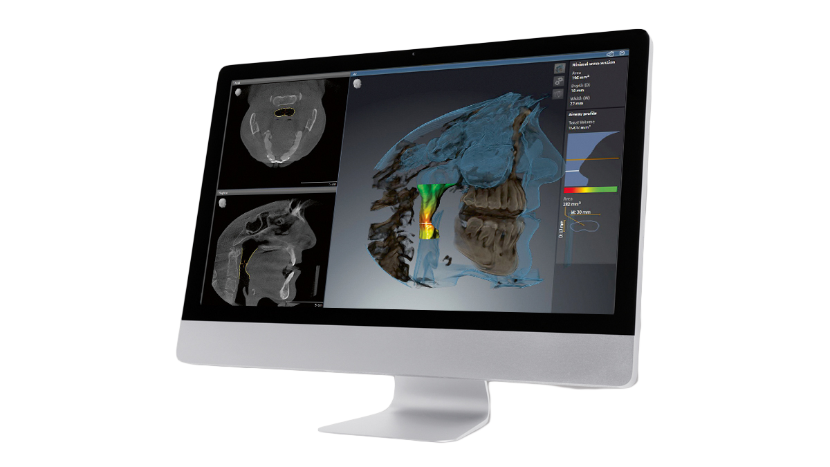 Image X screen SICAT Implant Monitor Air Mac