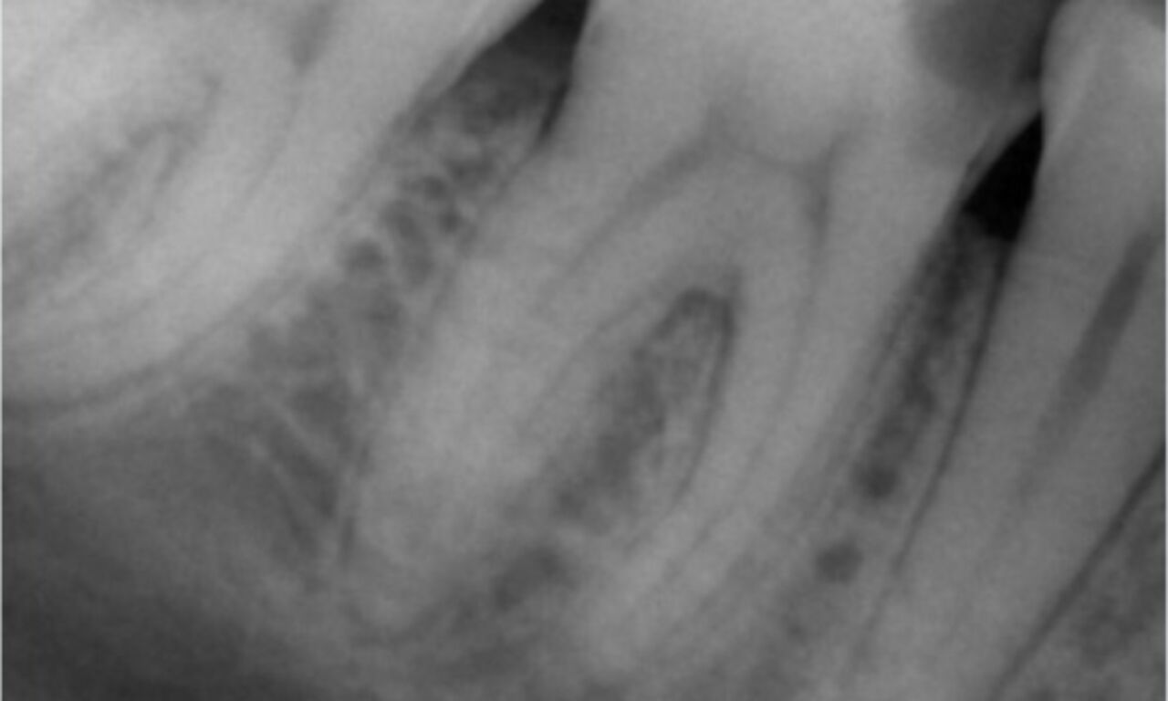 x ray clinical case Abuelezz TruNatomy Before