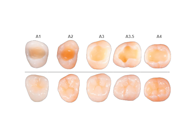 Guide to Class II Restoration Procedures | Dentsply Sirona AL