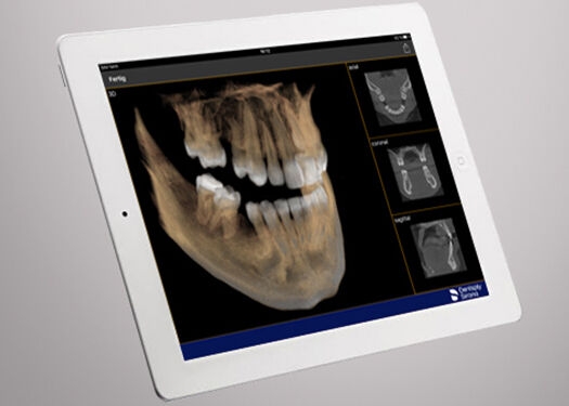Mobile dental imaging software tablet