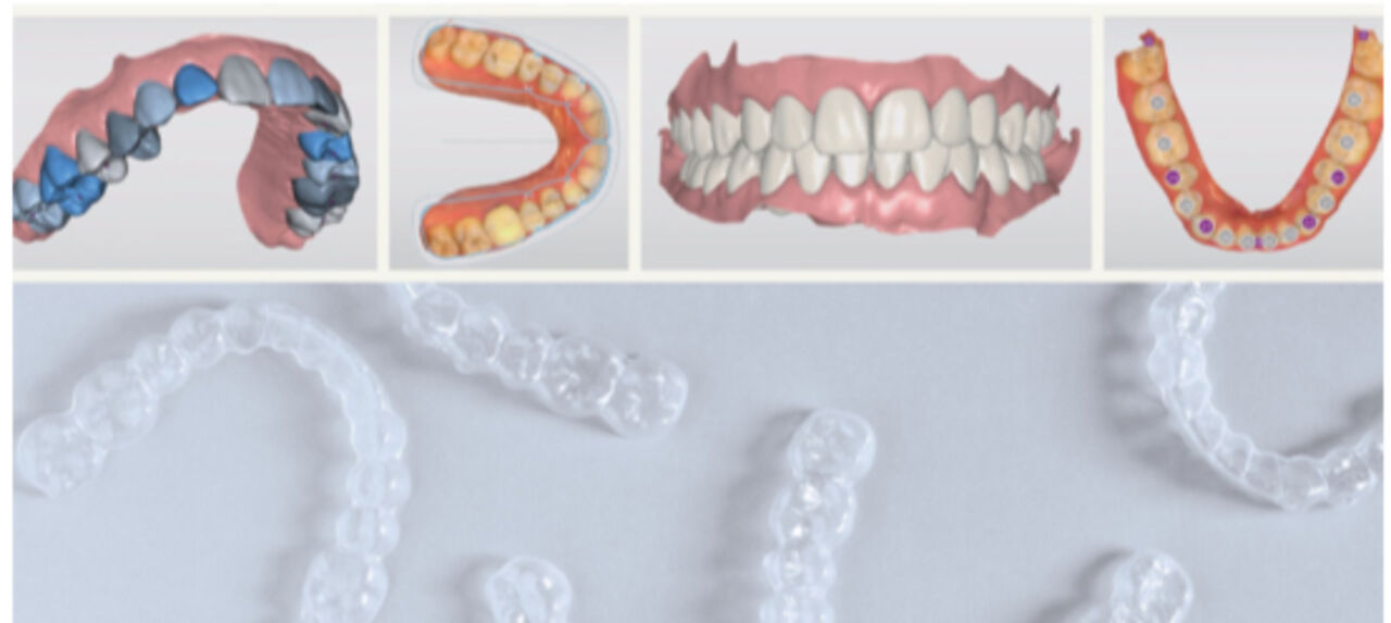 Collection of dental scan images and clear aligners. 