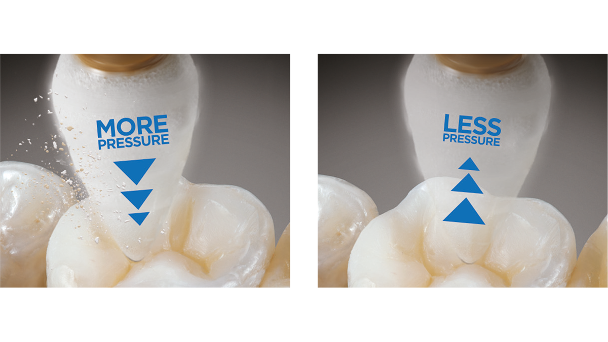 Enhance Finishing System Dentsply Sirona