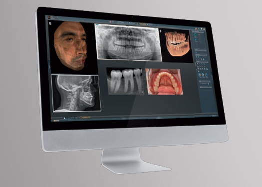 Dental X-Ray & Imaging Software