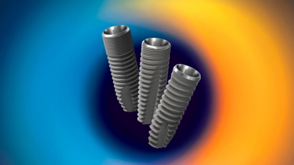 Implant systems