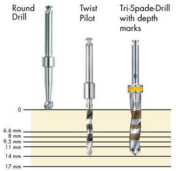 Ankylos Tri-Spade Drills (twist drills)