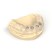Simplant Guide for tooth-supported restoration