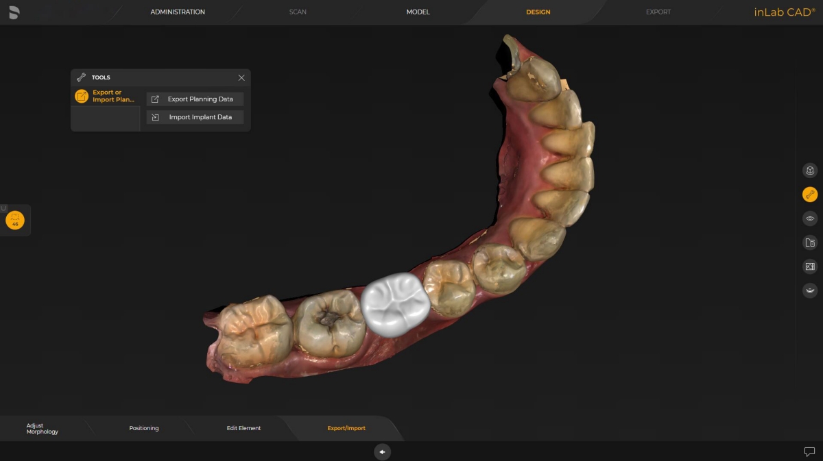 inLab CAD Software, surgical guide for integrated implantology