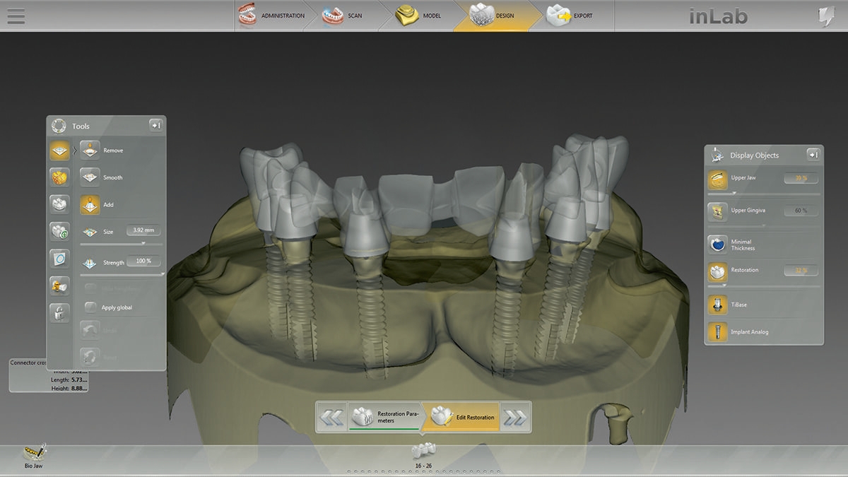 inLab CAD Software, Implantology module, screw retained bridge, multi-unit abutments