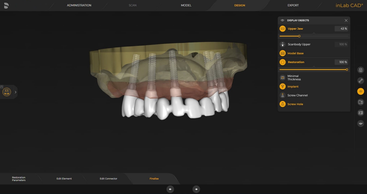 inLab CAD Software, Implantology module, individual abutment on TiBase