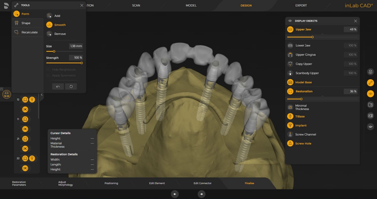 inLab CAD Software,  Implantology module