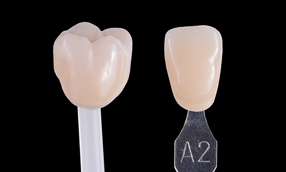 CEREC MTL Zirconia | Dentsply Sirona CA