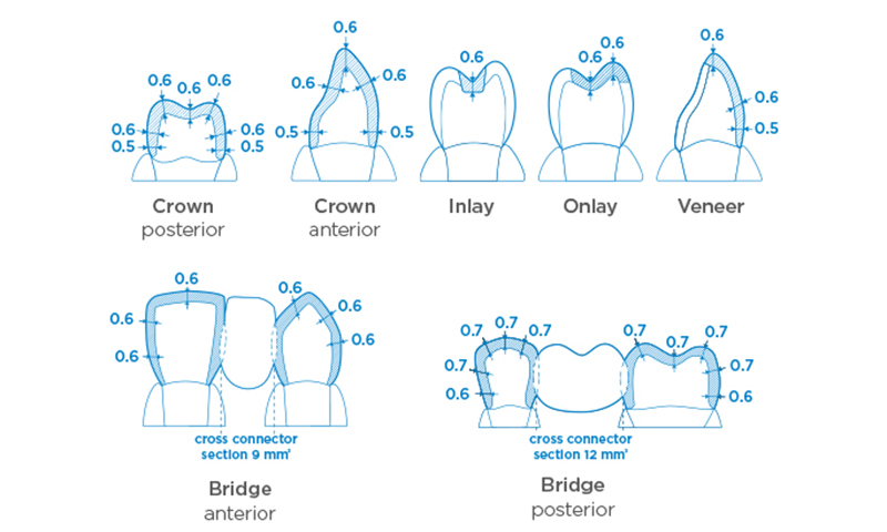 CEREC MTL Zirconia | Dentsply Sirona CA