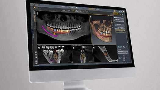 DS Academy Course Series | Dentsply Sirona DK