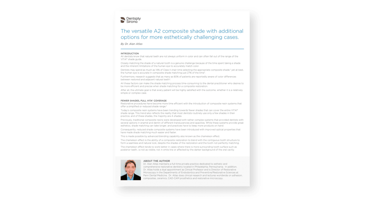 Ceram.x Spectra® ST | Dentsply Sirona UK
