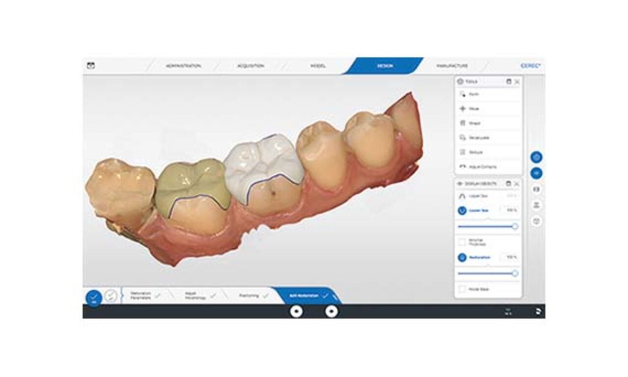 CAD/CAM solutions for dentists: Explore now | Dentsply Sirona UK