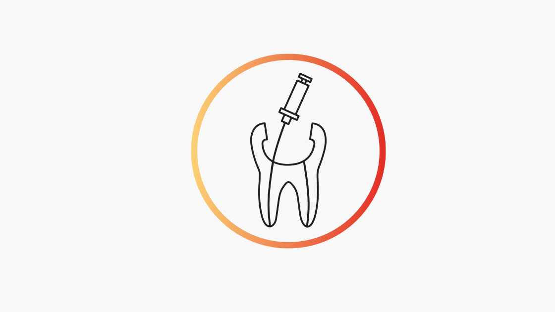 Endodontic root canal treatment Denstply Sirona Hong Kong