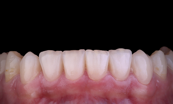 Case study  Cerec Tessera 