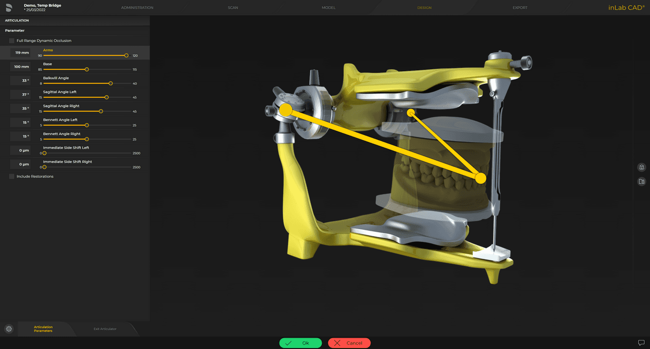 Virtual articulator  for visualising entire motion ranges and determining static and dynamic contact surfaces for proper functional occlusion.