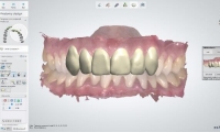 3Shape Dental System™ software