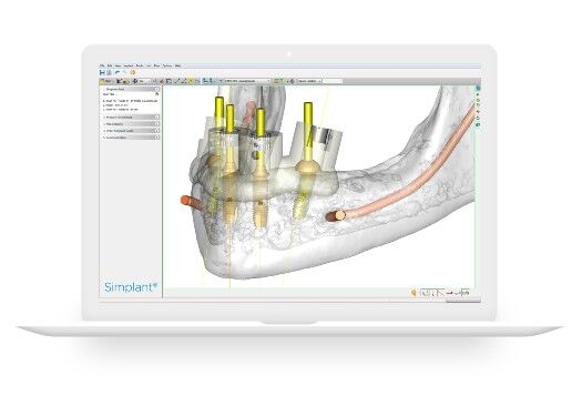 Monitor showing the Dental Software SICAT Implant