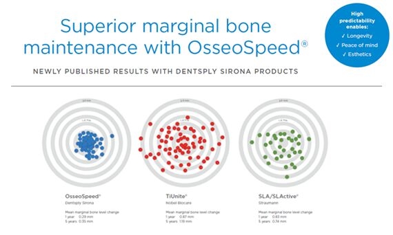 Marginal bone maintenance with OsseoSpeed