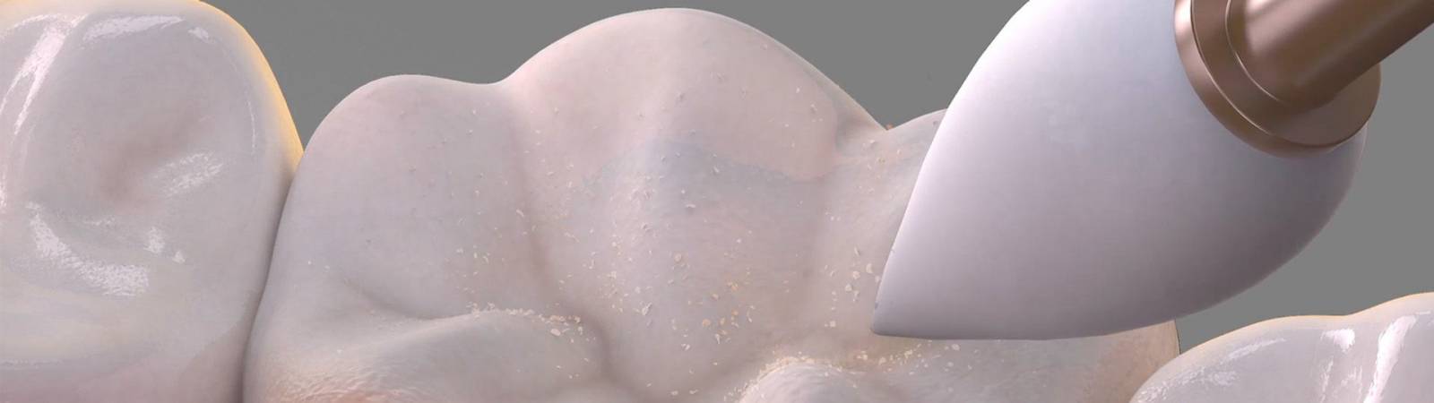 Finishing graphic