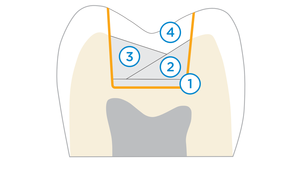 Composite Layering Illustration | SDR flow+