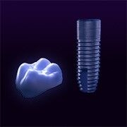 Implantology, crown and screw