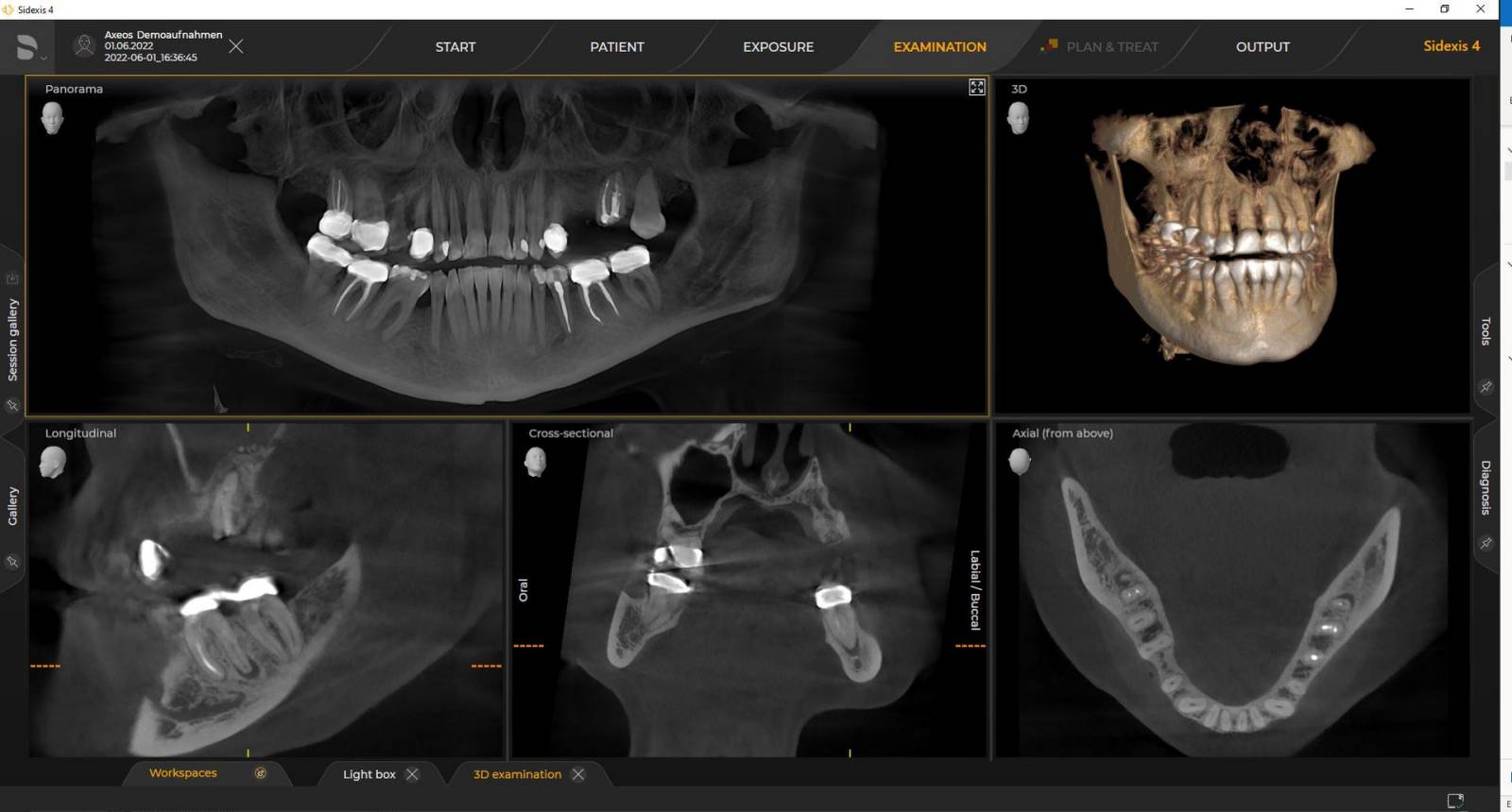 3D X-ray Ø 11 cm x 10 cm HD