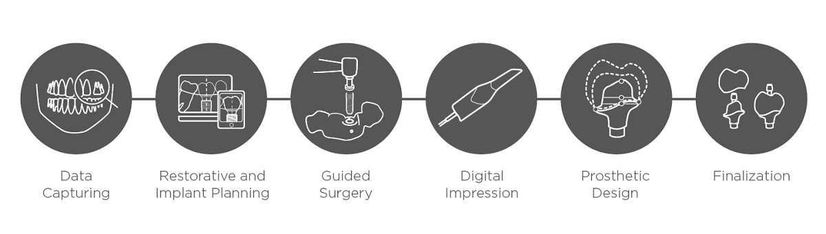 Digital Implant Workflow with Primescan