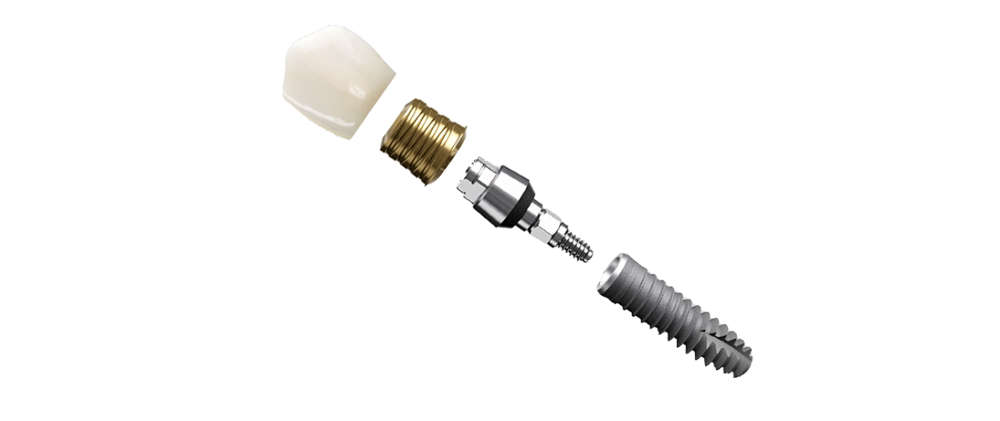 Acuris dentsply Implants instructions